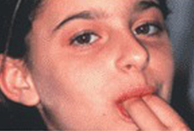 Oral habits