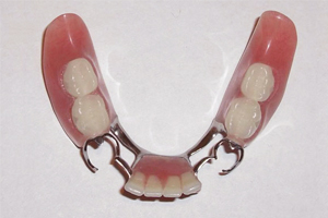 Partial dentures