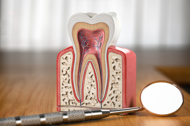 Root canal Colorado Springs CO