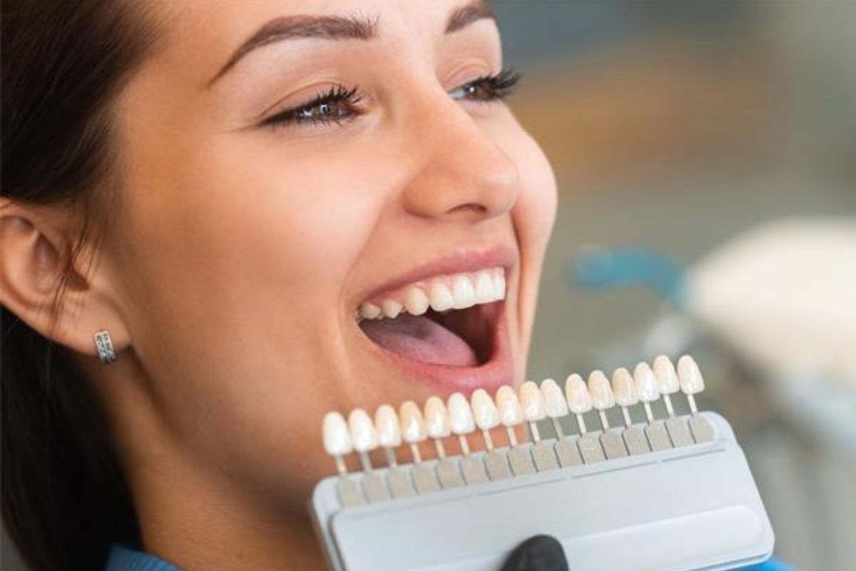 Transform Your Smile Instantly With Veneers