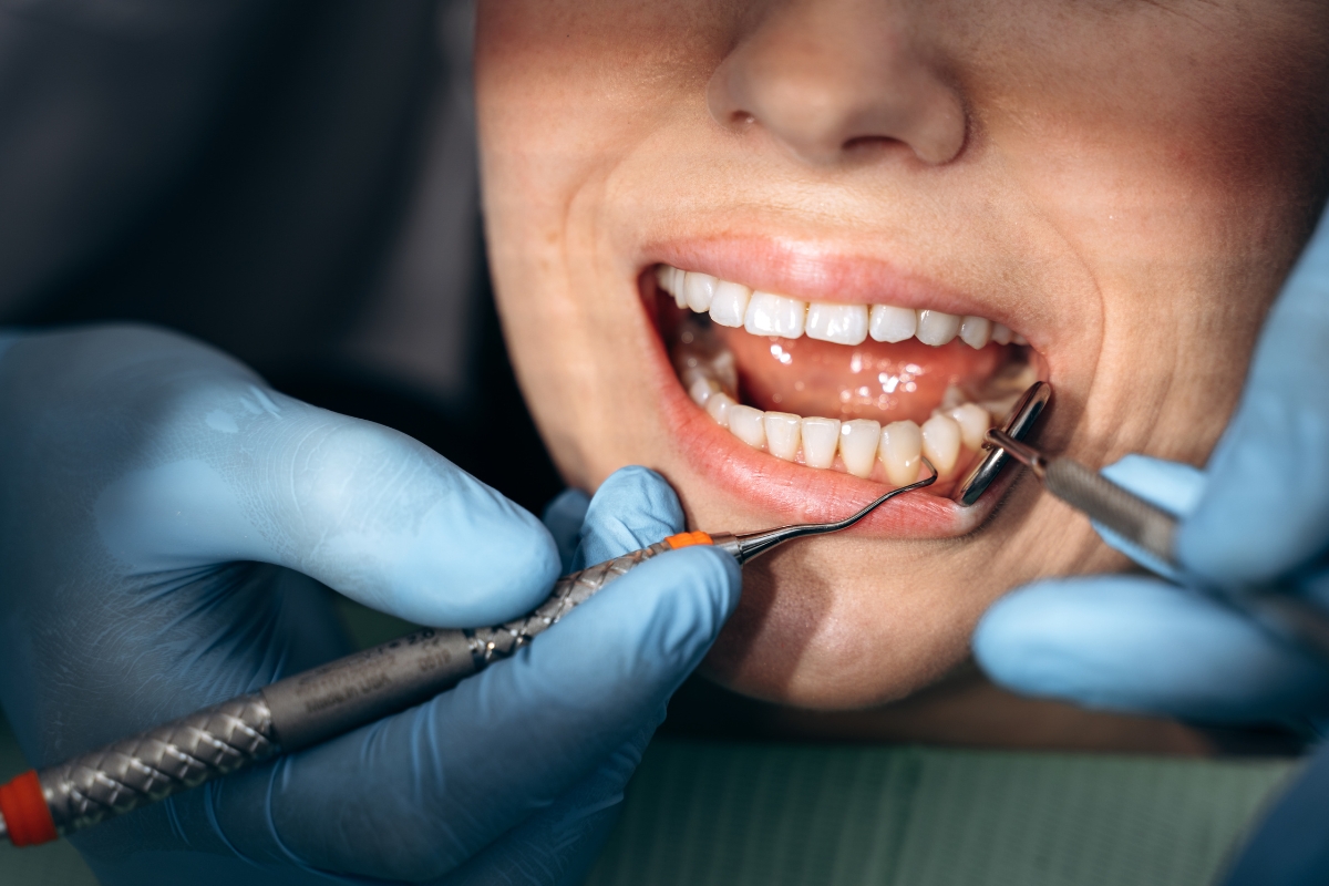 Colorado Springs Dentist Treating Dental Patients