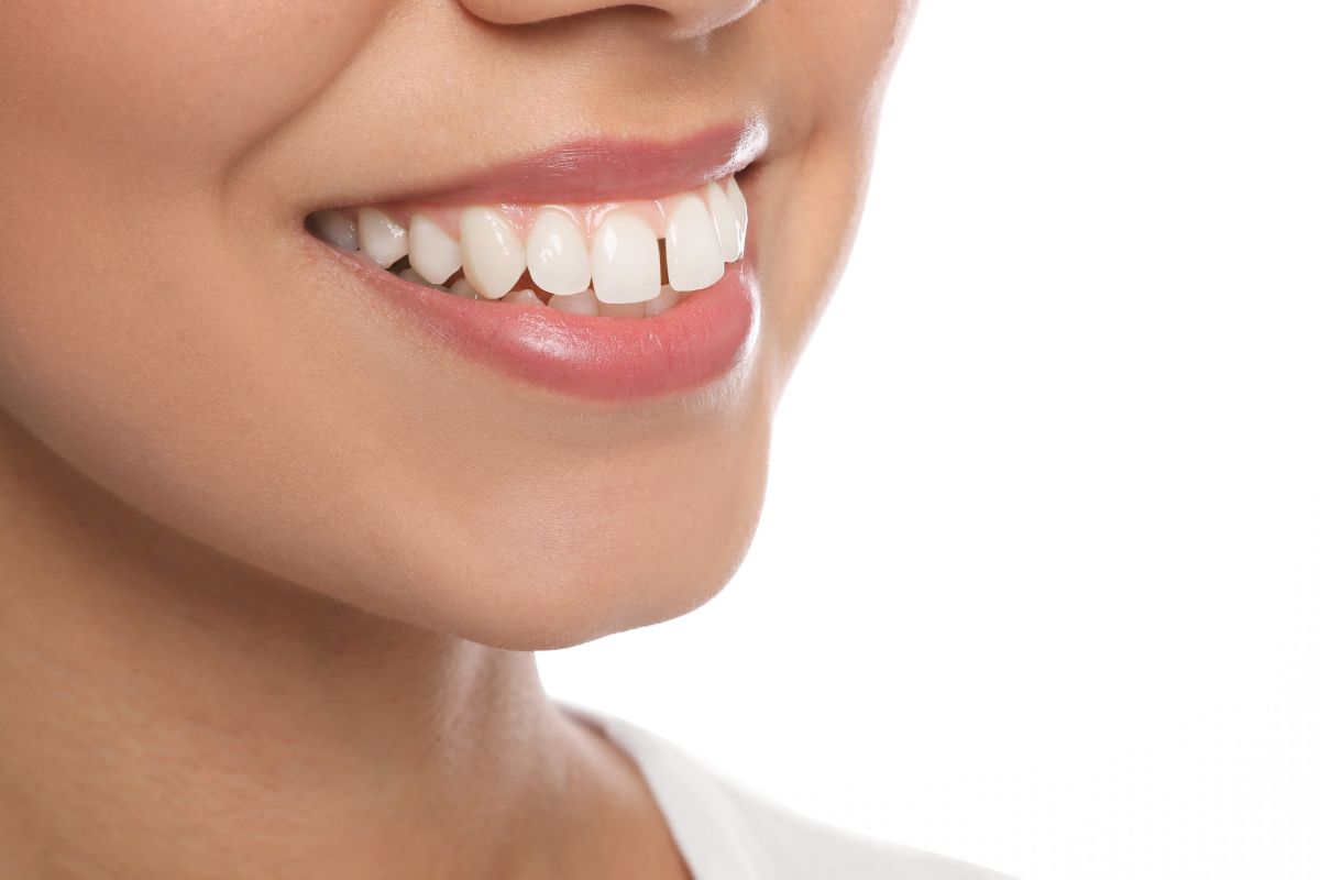 Can Invisalign Fix Severe Crowding or Bite Problems