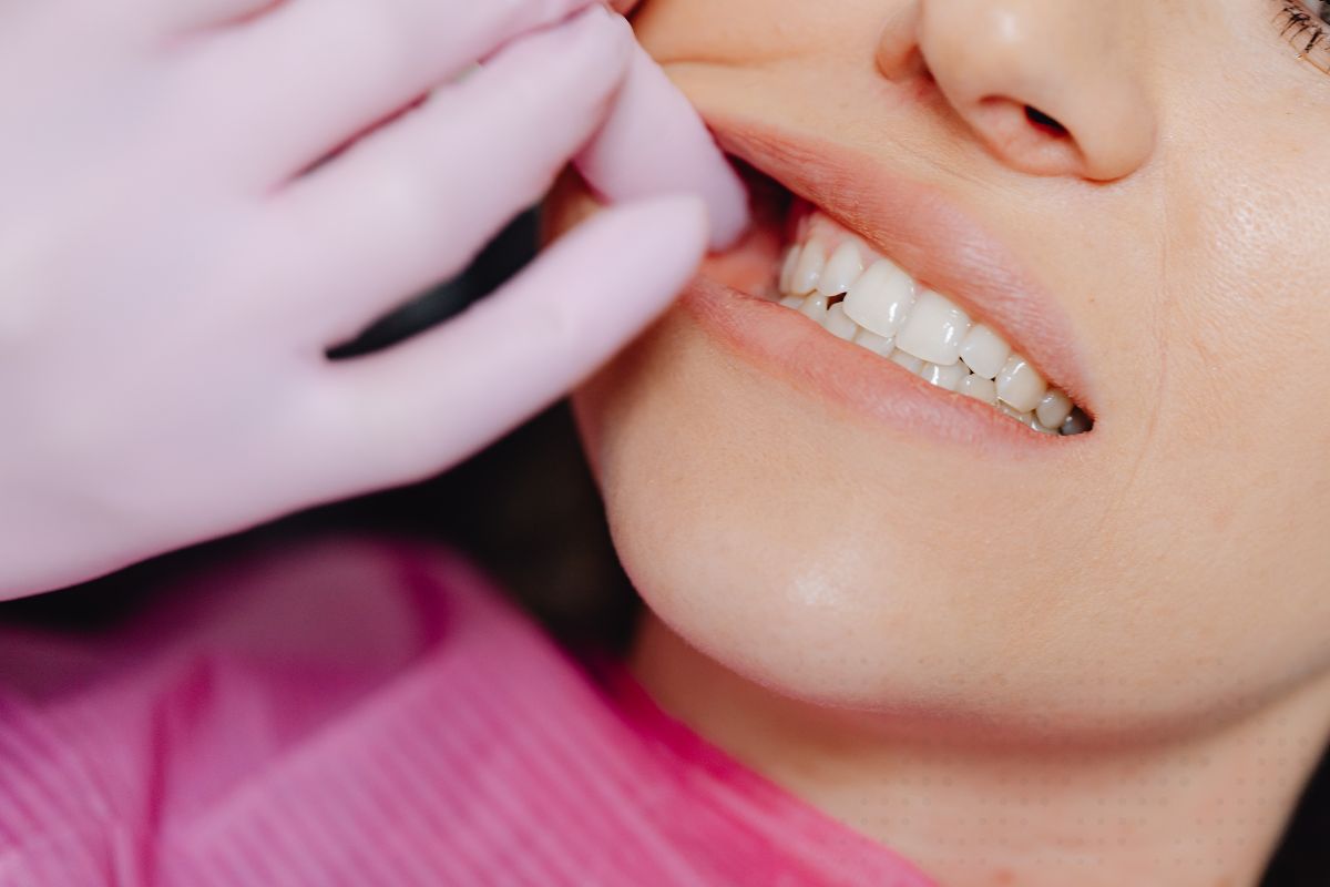 Common Dental Problems